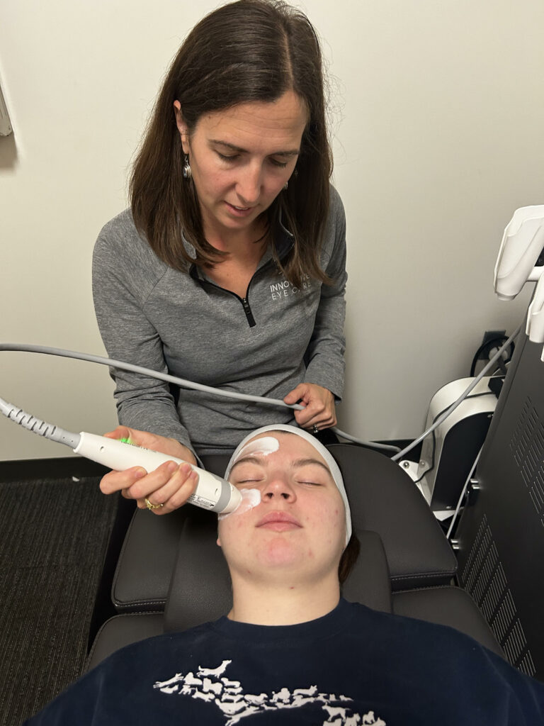 rf treatment for eyes